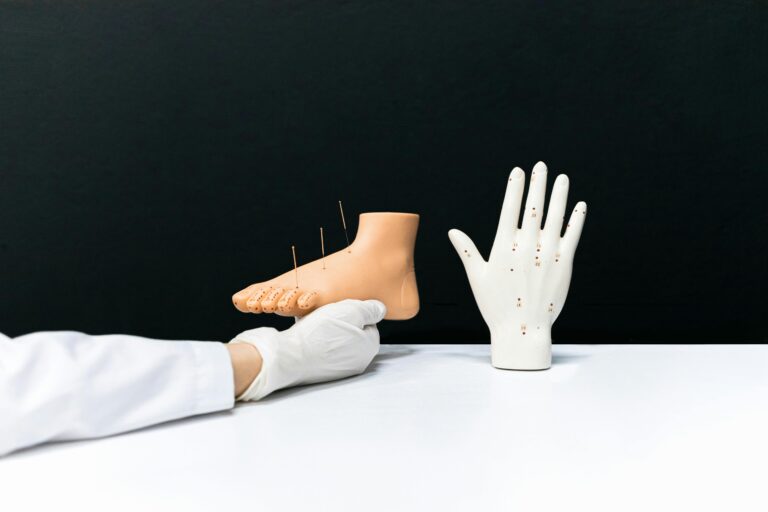 acupuncture near me